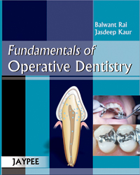 Fundamentals of Operative Dentistry (pdf)